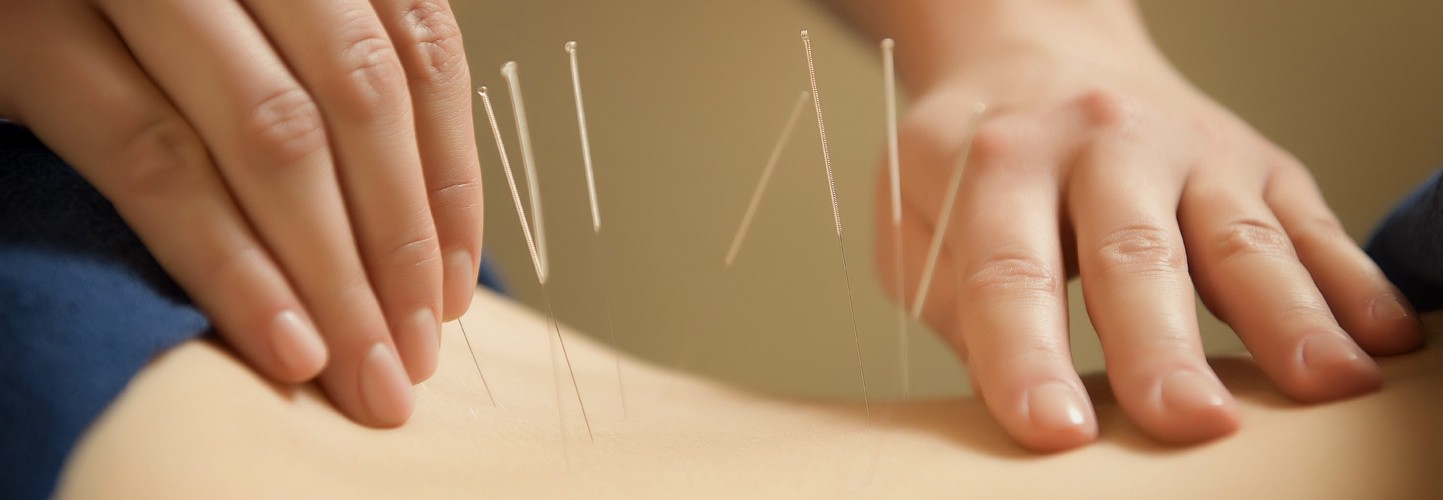 Acupuncture Treatment Holistic Homeopathic Natural Medicine Center Lakeland Central Florida