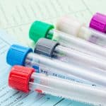 Blood test Vials